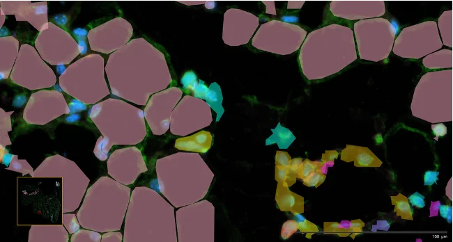 statistical_analysis_7